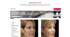 Desktop Screenshot of keloidsnyc.com