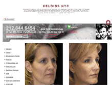 Tablet Screenshot of keloidsnyc.com